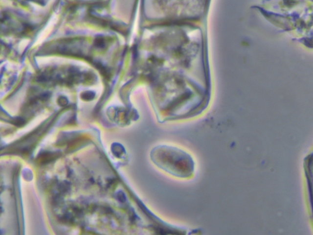 Botryobasidium con spore finemente verrucose